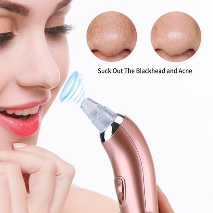 Blackheads Remover & Pore Cleaner - iamlazy.store