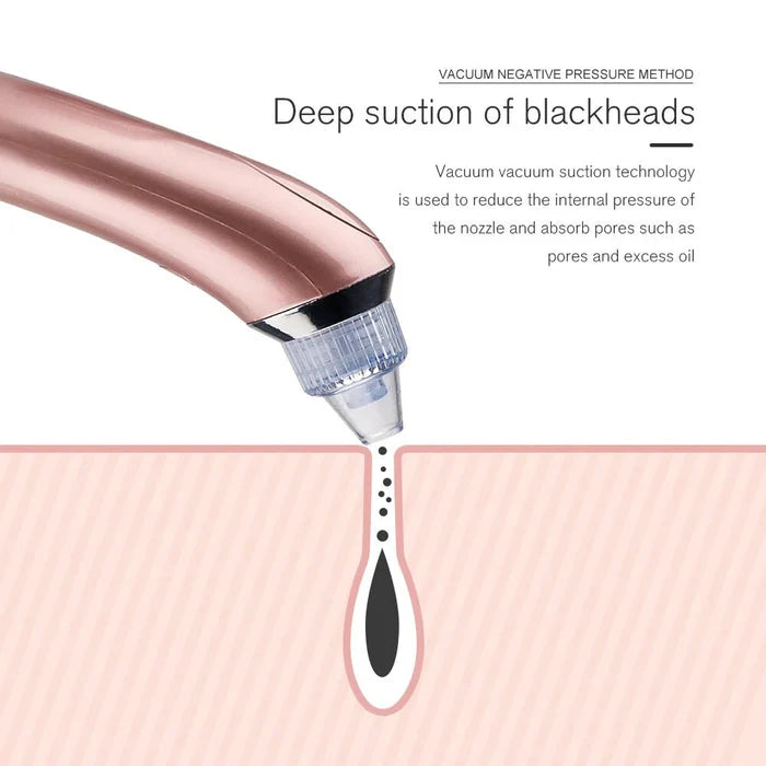 Blackheads Remover & Pore Cleaner - iamlazy.store