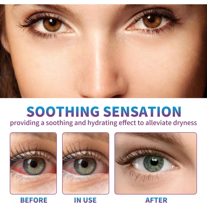 EyeRevive Patches™ (10pcs Box)