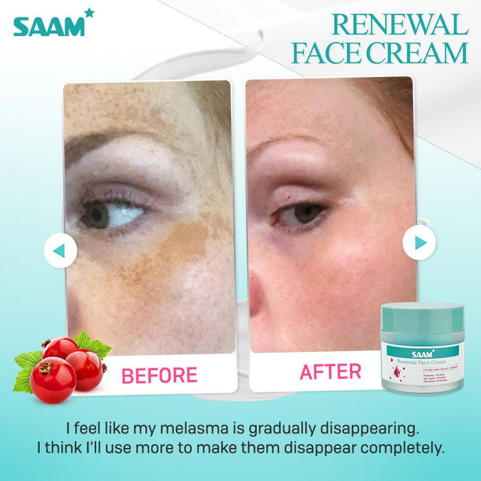 SAAM RENEWAL CREAM - Original - iamlazy.store