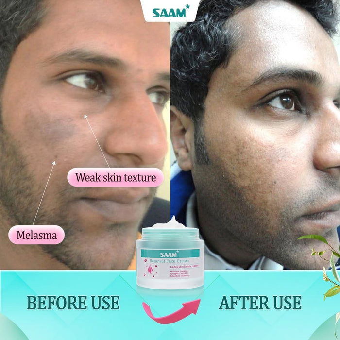 SAAM RENEWAL CREAM - Original - iamlazy.store