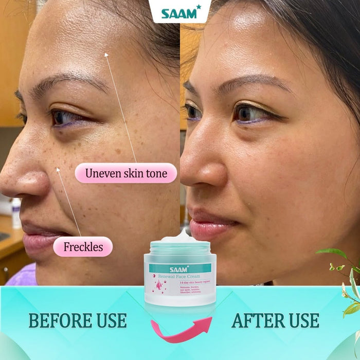 SAAM RENEWAL CREAM - Original - iamlazy.store