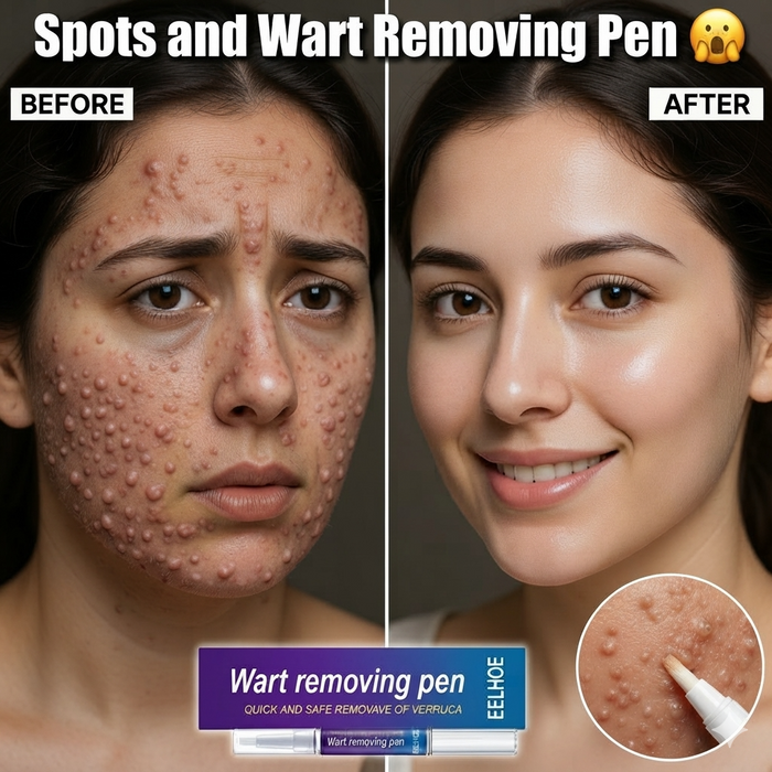 Spot Remover Pen