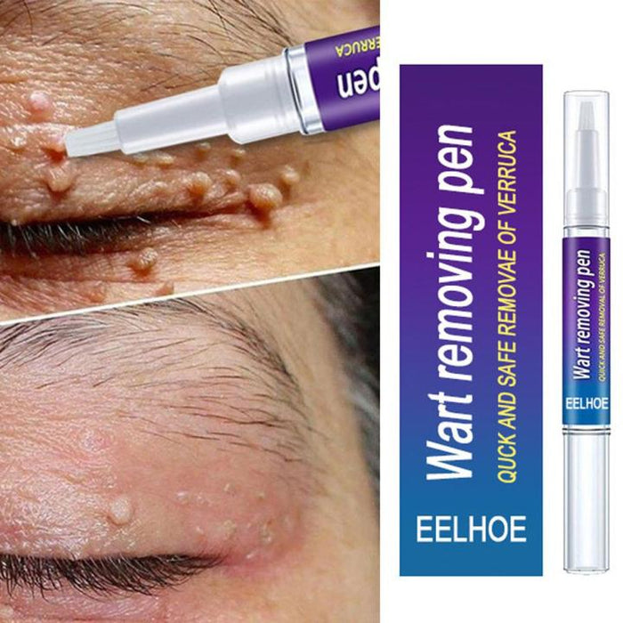 Spot Remover Pen