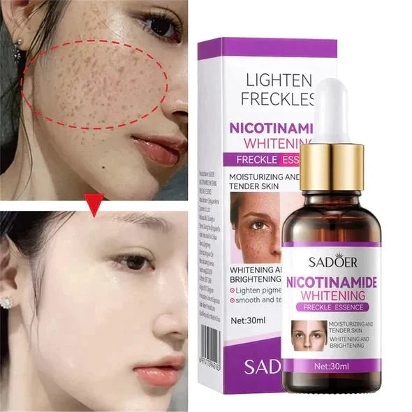 Spotty Serum - Original - iamlazy.store